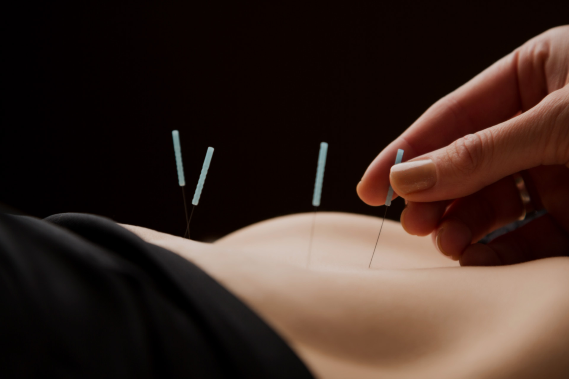 How Acupuncture Can Help With Pain During the Pandemic | Next Avenue